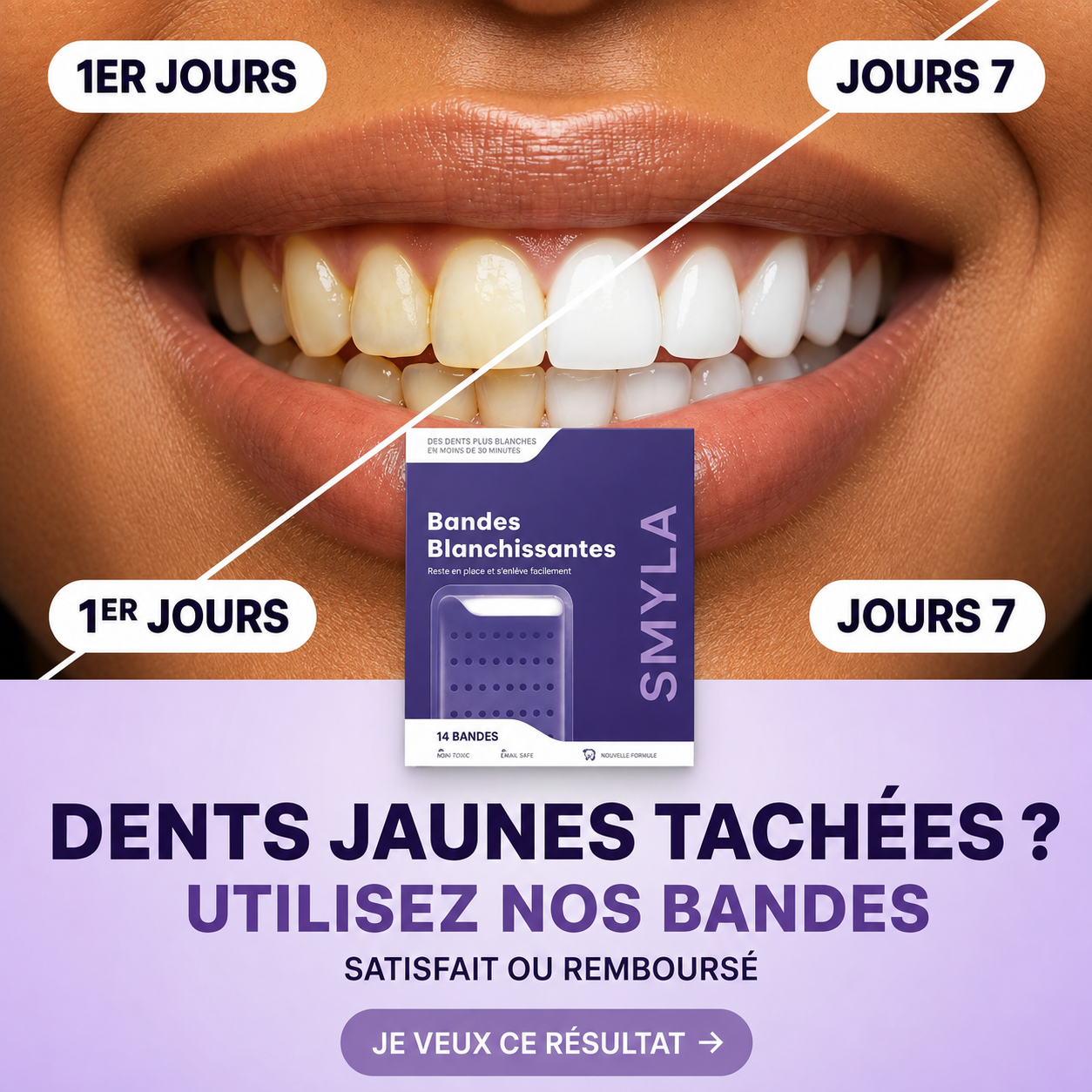 Bandes Blanchissantes Dentaires - Sourire Plus Blanc en 30 Minutes